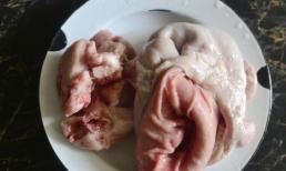 Đừng dùng muối kết hợp bột mì để rửa dạ dày, hãy dùng thứ này để rửa, rất nhanh lại sạch sẽ 