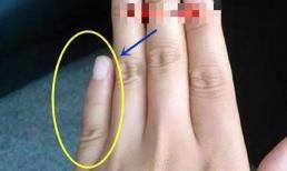 Ngón tay thứ năm đại diện cho sự may mắn hay xui xẻo của bạn trong những năm tháng sau này và khả năng của con cái, hãy cùng xem xét!