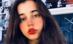 3 thói quen 'hủy diệt' nhất tuổi thanh xuân, ai rồi cũng sẽ trở nên xấu xí, đừng chạy theo trào lưu