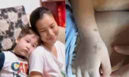 Con trai bị nổi đốm nâu trên da, Á hậu Hoàng Oanh lo lắng lên mạng hỏi các 'mẹ bỉm'