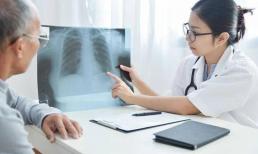 2 dấu hiệu 'đen' trong cơ thể và 1 dấu hiệu 'có mùi' có thể là ung thư phổi đã 'tấn công'
