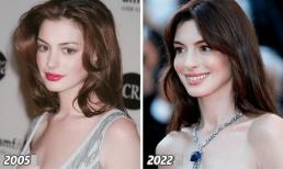 Tại sao ở tuổi 40, Anne Hathaway vẫn xinh đẹp như vậy?