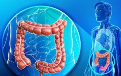 Làm thế nào để phát hiện sớm ung thư đại trực tràng? 6 phương pháp tự đánh giá này và 3 phương pháp kiểm tra cần biết 