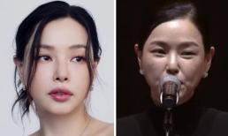 Ảnh đã qua chỉnh sửa và thực tế của 'Hoa hậu đẹp nhất xứ Hàn' có sự chênh lệch đáng ngạc nhiên 