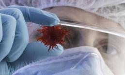 Mất bao lâu để chuyển từ 'viêm' sang 'ung thư'? Nhắc nhở: cố gắng không trì hoãn 3 loại viêm