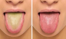 5 điều có thể xảy ra với cơ thể nếu bạn cạo lưỡi khi thức dậy