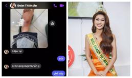 Hoa hậu Đoàn Thiên Ân khiến fan lo lắng vì vết thương ở chân sau những lần chinh chiến