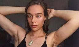 Nếu phụ nữ sở hữu một lớp lông dày ở “ba nơi” trên cơ thể thì bạn là người may mắn phải không?