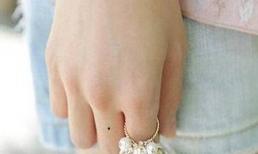 Người có nốt ruồi này trên tay thì phúc lộc trường thọ, bạn có không?