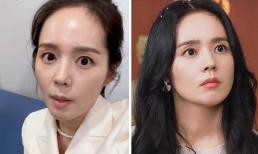 Sau khi bị chê 'xuống sắc không phanh', mỹ nhân 'Mặt trăng ôm mặt trời' đã lột xác như thế nào?