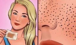 8 sai lầm khi chăm sóc da khiến lỗ chân lông nở to