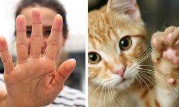 Lý do tại sao con người có 5 ngón tay chứ không phải là 4 hay 6 ngón?