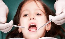 Nên làm gì nếu răng của con bị khấp khểnh?