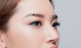 Nốt ruồi nghèo khó mọc ở đâu? Nốt ruồi mọc ở đâu sẽ giàu có trong tương lai?