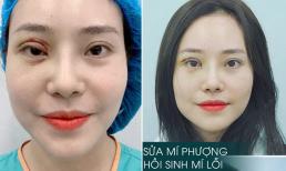 Khóc ròng vì pha cắt mí mắt 'lợn lành biến thành lợn què' tại thẩm mỹ chui