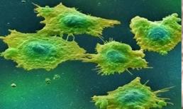 3 loại thực phẩm giàu tính kiềm là thiên địch của ung thư, ăn một ít mỗi ngày, biết đâu tế bào ung thư sẽ không 'đến gần' bạn