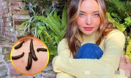 Đưa đỉa lên mặt? 8 thói quen làm đẹp của người nổi tiếng mà bạn sẽ không muốn thử