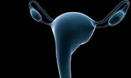 4 kiểu phụ nữ này càng dễ mắc bệnh phụ khoa, nếu bạn không nằm trong số đó thì tử cung vẫn khỏe mạnh