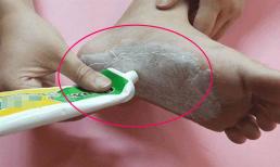 Nhiều người không hiểu công dụng của kem đánh răng đối với bàn chân, học các mẹo sau để sử dụng nó cả đời