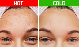 Nên rửa mặt bằng nước nóng hay nước lạnh vào mùa đông? 