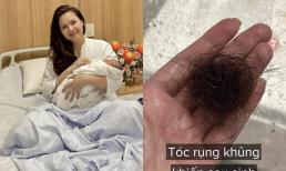 Hậu sinh nở lần 2, Phanh Lee rụng tóc đến mức bị ám ảnh