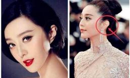 Đôi tai khác nhau và số phận khác nhau? Sự khác biệt giữa 'tai của người nghèo' và 'tai của người giàu' là gì? 