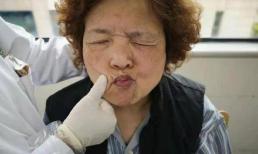 Đã tìm ra 'nguyên nhân chính' của nhồi máu não? Bác sĩ: Hãy ngừng ăn '1 đỏ 2 trắng'