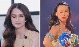 Chuyện gì xảy ra với một bên mắt của 'Mỹ nhân đẹp nhất Philippines', liệu giống với trường hợp của Katy Perry?