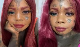 Người phụ nữ bị mù sau khi xăm mắt xanh và tím