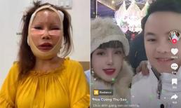 Nhan sắc khác lạ của 'cô dâu 62 tuổi' ở Cao Bằng sau 3 năm biến chứng vì 'dao kéo'