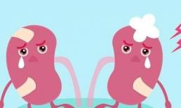 Đừng nghĩ chỉ có đàn ông mới bị thận hư, bạn đã nắm được những biểu hiện chủ yếu của chứng thận hư ở phụ nữ chưa? 