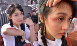 'Thánh nữ nhạc chế' Hậu Hoàng gặp vận xui cuối năm, fans nhìn thấy mà xót xa