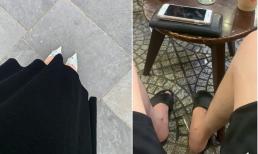 Ăn mặc lồng lộn trong lần hẹn hò đầu tiên, cô gái bị bạn trai 'chửi sấp mặt', bỏ lại giữa đường