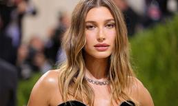 Vợ Justin Bieber vật lộn với hội chứng rối loạn căng thẳng sau sang chấn