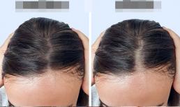 10 thói quen hàng ngày khiến tóc mỏng đi
