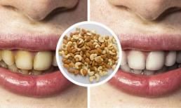 6 cách tẩy trắng răng an toàn