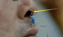 Người đàn ông có lông mũi luôn 'bung ra' ám chỉ điều gì? Tại sao lông mũi chuyển sang màu trắng?