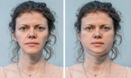 11 tác hại bất ngờ của việc thiếu và thừa giấc ngủ