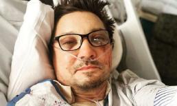 Tài tử phim Marvel - Jeremy Renner bị gãy hơn 30 chiếc xương trong tai nạn máy cày tuyết
