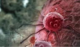 Bất kể nam hay nữ, nếu bạn thường xuyên ngứa ngáy 'chỗ này' thì có thể tế bào ung thư đang 'xâm lấn', bạn cũng nên xem qua