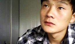 Có nốt ruồi tốt và xấu, nốt ruồi tốt có thể mang lại may mắn, nhưng những nốt ruồi này tốt nhất nên tẩy đi