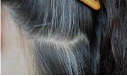 Tóc trắng mọc ở đâu và mắc bệnh gì? Tóc trắng trên trán, thái dương và sau gáy có ý nghĩa gì?