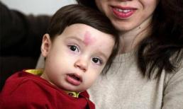 Không muốn con mình có vết bớt, các bà mẹ tương lai nên bớt làm những việc này sau khi mang thai 