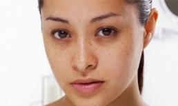 Con gái có 3 đặc điểm này trên mặt sau 18 tuổi sẽ càng 'dài và xấu ' đấy, mong bạn đừng mắc phải