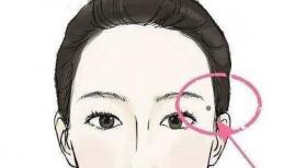 Xem nốt ruồi: phụ nữ có những nốt ruồi này trên mặt không gặp nhiều may mắn, sẽ tốt hơn nếu tẩy đi