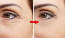 7 loại dầu tự nhiên có khả năng kỳ diệu chống lại nếp nhăn