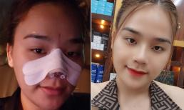 'Thánh sún' Ngân Thảo khoe cận cảnh gương mặt sau khi sửa mũi