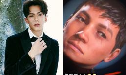 Kha Chấn Đông lộ sẹo dài trên mặt hậu chấn thương nặng do tai nạn tại phim trường