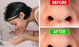 10 cách bạn có thể điều trị các vấn đề về da mà không tốn nhiều tiền