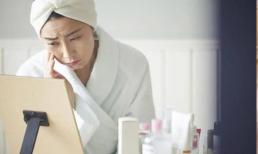 Bước vào độ tuổi trung niên, làn da dễ bị xỉn màu về lâu ngày? 4 điều giúp bạn làm mờ vết đồi mồi